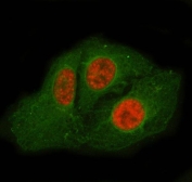 Immunofluorescent staining of FFPE human U-2 OS cells with SF3a66 antibody (green) and Beta Tubulin mAb (green). HIER: steam section in pH6 citrate buffer for 20 min.