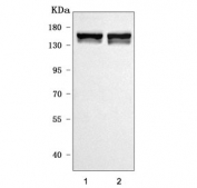Western blot testing of 1) rat brain and 2) mouse brain tissue lysate with Liprin alpha 2 antibody. Predicted molecular weight ~143 KDa.