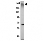 Western blot testing of human HepG2 cell lysate with MRP3 antibody. Predicted molecular weight ~169 kDa but may be observed at higher molecular weights due to glycosylation.