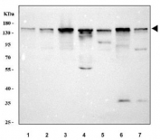 Western blot testing of 1) human A549, 2) human 293T, 3) human MCF7, 4) rat brain, 5) rat C6, 6) mouse brain and 7) mouse NIH 3T3 cell lysate with TSC22D1 antibody. Predicted molecular weight ~110 kDa.