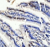 IHC staining of FFPE mouse colon tissue with PRPF4 antibody. HIER: boil tissue sections in pH8 EDTA for 20 min and allow to cool before testing.