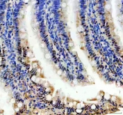 IHC staining of FFPE rat colon tissue with PRPF4 antibody. HIER: boil tissue sections in pH8 EDTA for 20 min and allow to cool before testing.