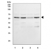 Western blot testing of human 1) HaCaT, 2) SiHa, 3) A549 and 4) HeLa cell lysate with PRPF4 antibody. Predicted molecular weight ~58 kDa.