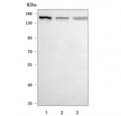 Western blot testing of human 1) 293T, 2) Jurkat and 3) PC-3 cell lysate with NEMF antibody. Predicted molecular weight ~123 kDa, commonly observed at 123-140 kDa.