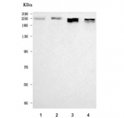 Western blot testing of human 1) U-2 OS, 2) U-251, 3) HeLa and 4) PC-3 cell lysate with NCOR2 antibody. Predicted molecular weight: 267-274 kDa, ~81 kDa (multiple isoforms).