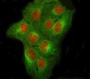 Immunofluorescent staining of FFPE human U-2 OS cells with NCOR2 antibody (red) and Beta Tubulin mAb (green). HIER: steam section in pH6 citrate buffer for 20 min.
