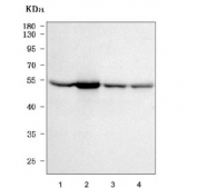 Western blot testing of human 1) MCF7, 2) K562, 3) HeLa and 4) HepG2 cell lysate with PPM1F antibody. Predicted molecular weight ~50 kDa.