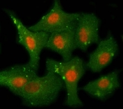 Immunofluorescent staining of FFPE human A549 cells with PPM1F antibody (red) and Beta Tubulin mAb (green). HIER: steam section in pH6 citrate buffer for 20 min.