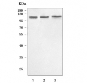 Western blot testing of human 1) HepG2, 2) RT4 and 3) Jurkat cell lysate with N4BP1 antibody. Predicted molecular weight ~100 kDa.