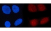 Immunofluorescent staining of FFPE human HeLa cells with N4BP1 antibody (red) and DAPI nuclear stain (blue). HIER: steam section in pH6 citrate buffer for 20 min.