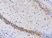 IHC staining of FFPE mouse brain tissue with PSMD14 antibody. HIER: boil tissue sections in pH8 EDTA for 20 min and allow to cool before testing.