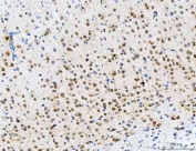 IHC staining of FFPE rat brain tissue with PSMD14 antibody. HIER: boil tissue sections in pH8 EDTA for 20 min and allow to cool before testing.