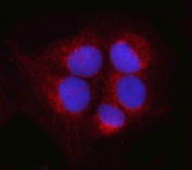 Immunofluorescent staining of FFPE human U-2 OS cells with PSMD14 antibody (red) and DAPI nuclear stain (blue). HIER: steam section in pH6 citrate buffer for 20 min.