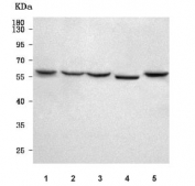 Western blot testing of 1) human A549, 2) human MCF7, 3) human HEL, 4) rat brain and 5) mouse brain tissue lysate with TMEM5 antibody. Predicted molecular weight ~51 kDa.