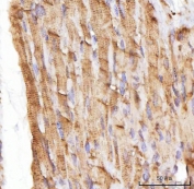 IHC staining of FFPE rat heart tissue with Nebulette antibody. HIER: boil tissue sections in pH8 EDTA for 20 min and allow to cool before testing.