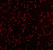 Immunofluorescent staining of FFPE mouse brain tissue with SAM68 antibody (red). HIER: steam section in pH8 EDTA buffer for 20 min.