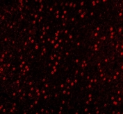 Immunofluorescent staining of FFPE mouse brain tissue with SAM68 antibody (red). HIER: steam section in pH8 EDTA buffer for 20 min.