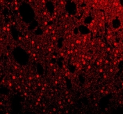 Immunofluorescent staining of FFPE rat brain tissue with SAM68 antibody (red). HIER: steam section in pH8 EDTA buffer for 20 min.