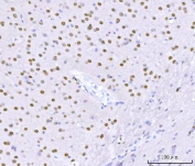 IHC staining of FFPE mouse brain tissue with SAM68 antibody. HIER: boil tissue sections in pH8 EDTA for 20 min and allow to cool before testing.