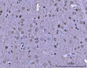 IHC staining of FFPE rat brain tissue with SAM68 antibody. HIER: boil tissue sections in pH8 EDTA for 20 min and allow to cool before testing.