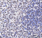 IHC staining of FFPE human spleen tissue with SAM68 antibody. HIER: boil tissue sections in pH8 EDTA for 20 min and allow to cool before testing.
