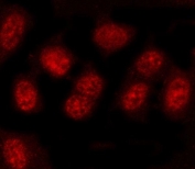 Immunofluorescent staining of FFPE human U-2 OS cells with PRDM4 antibody (red). HIER: steam section in pH6 citrate buffer for 20 min.
