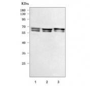 Western blot testing of human 1) HeLa, 2) MCF7 and 3) 293T cell lysate with Checkpoint kinase 2 antibody. Predicted molecular weight ~61 kDa (multiple isoforms).