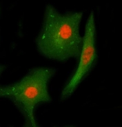 Immunofluorescent staining of FFPE human A549 cells with Checkpoint kinase 2 antibody (red) and Beta Tubulin mAb (green). HIER: steam section in pH6 citrate buffer for 20 min.