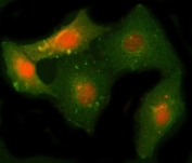 Immunofluorescent staining of FFPE human A549 cells with NCAPH antibody (red) and Beta Tubulin mAb (green). HIER: steam section in pH6 citrate buffer for 20 min.
