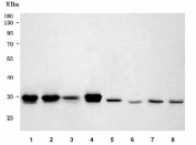 Western blot testing of 1) human HeLa, 2) human Jurkat, 3) human ThP-1, 4) human K562, 5) rat brain, 6) rat thymus, 7) mouse brain and 8) mouse thymus tissue lysate with PYCR2 antibody. Predicted molecular weight ~34 kDa.