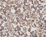 IHC staining of FFPE human testicular seminoma tissue with Selenocysteine lyase antibody. HIER: boil tissue sections in pH8 EDTA for 20 min and allow to cool before testing.