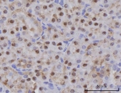 IHC staining of FFPE mouse kidney tissue with Selenocysteine lyase antibody. HIER: boil tissue sections in pH8 EDTA for 20 min and allow to cool before testing.