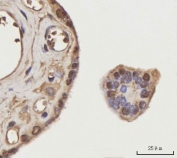 IHC staining of FFPE human placental tissue with NEIL3 antibody. HIER: boil tissue sections in pH8 EDTA for 20 min and allow to cool before testing.