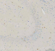 Immunohistochemical staining of FFPE mouse hippocampus tissue with NECAB1 antibody, HRP-secondary and DAB substrate. HIER: boil tissue sections in pH8 EDTA for 20 min and allow to cool before testing.