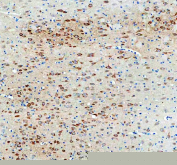 Immunohistochemical staining of FFPE rat brain tissue with NECAB1 antibody, HRP-secondary and DAB substrate. HIER: boil tissue sections in pH8 EDTA for 20 min and allow to cool before testing.