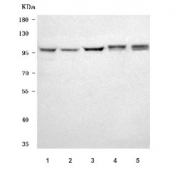 Western blot testing of 1) human HeLa, 2) human 293T, 3) human K562, 4) rat brain and 5) mouse brain tissue lysate with NAA15 antibody. Predicted molecular weight ~101 kDa.