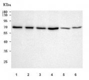 Western blot testing of 1) human 293T, 2) human SH-SY5Y, 3) human Jurkat, 4) human HeLa, 5) rat brain and 6) mouse brain tissue lysate with NEDD1 antibody. Predicted molecular weight: ~72 kDa, ~62 kDa (two isoforms).