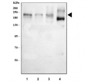 Western blot testing of 1) human 293T, 2) human A549, 3) human U-2 OS and 4) rat brain tissue lysate with GLI2 antibody. Predicted molecular weight: 86~168 kDa (multiple isoforms).