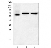 Western blot testing of 1) human A375, 2) rat brain and 3) mouse brain tissue lysate with SOX10 antibody. Expected molecular weight: 50-58 kDa.