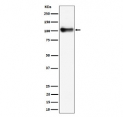 Western blot testing of mouse lung tissue lysate with Thbd antibody. Expected molecular weight ~60/100 kDa (unmodified/glycosylated).