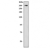 Western blot testing of human HepG2 cell lysate with CHD8 antibody. Predicted molecular weight ~290 kDa.
