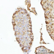 IHC staining of FFPE mouse testis tissue with GHRH antibody. HIER: boil tissue sections in pH8 EDTA for 20 min and allow to cool before testing.