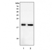 Western blot testing of 1) rat heart and 2) mouse heart tissue lysate with Dtr antibody. Predicted molecular weight ~23 kDa but may be observed at higher molecular weights due to glycosylation.