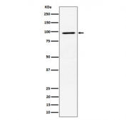 Western blot testing of human MCF7 cell lysate with RSK2 antibody. Predicted molecular weight ~84 kDa, commonly observed at 84-90 kDa.