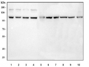 Western blot testing of 1) human COLO-320, 2) human HepG2, 3) human 293T, 4) human HeLa, 5) human PC-3, 6) human K562, 7) human HEL, 8) rat PC-12, 9) mouse testis and 10) mouse NIH 3T3 cell lysate with Nucleoporin 107 antibody. Predicted molecular weight ~107 kDa.
