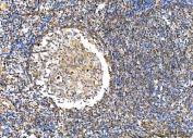 IHC staining of FFPE human tonsil tissue with NVL antibody. HIER: boil tissue sections in pH8 EDTA for 20 min and allow to cool before testing.