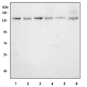 Western blot testing of 1) human K562, 2) human SiHa, 3) human PC-3, 4) rat testis, 5) rat C6 and 6) mouse testis tissue lysate with Nardilysin antibody. Predicted molecular weight ~132 kDa.