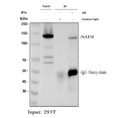 Immunoprecipitation of NAT10 protein from 500ug of human 293T whole cell lysate with 2ug of NAT10 antibody.