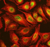 Immunofluorescent staining of FFPE human U-2 OS cells with NSMCE2 antibody (green) and Beta Tubulin mAb (red). HIER: steam section in pH6 citrate buffer for 20 min.