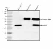 Immunoprecipitation of NSMCE2 protein from 500ug of human MCF7 whole cell lysate with 2ug of NSMCE2 antibody.